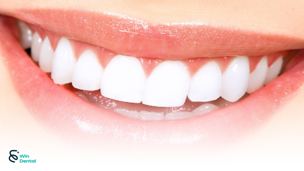 Các dáng răng sứ phổ biến hiện nay – Nên chọn dáng nào phù hợp với bạn? 1 111png