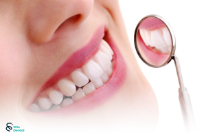 Răng sứ thẩm mỹ: Ưu điểm vượt trội và hạn chế cần biết 2 Răng sứ thẩm mỹ: Ưu điểm vượt trội và hạn chế cần biết