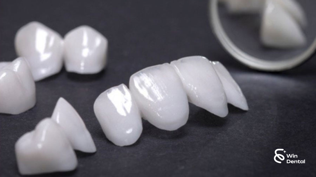 Độ bền của răng sứ thẩm mỹ là bao lâu? 1 52