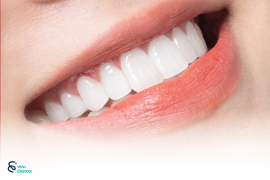 Nên chọn loại răng sứ nào? Giá & đặc điểm từng loại 2 Nên chọn loại răng sứ nào? Giá & đặc điểm từng loại