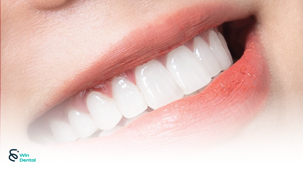 Nên chọn loại răng sứ nào? Giá & đặc điểm từng loại 1 8 1