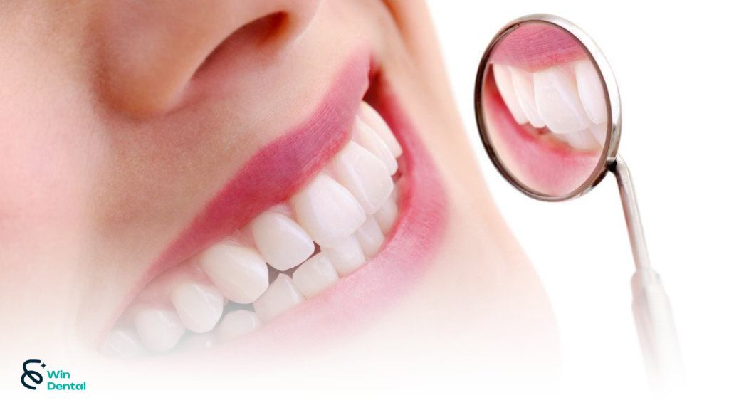 Răng sứ thẩm mỹ: Ưu điểm vượt trội và hạn chế cần biết 1 9