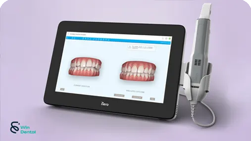 Trang chủ 60 Cong nghe May iTero Element 5D Plus V1