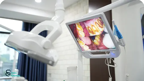 Trang chủ 64 Cong nghe May soi khoang mieng Osaka dent V1