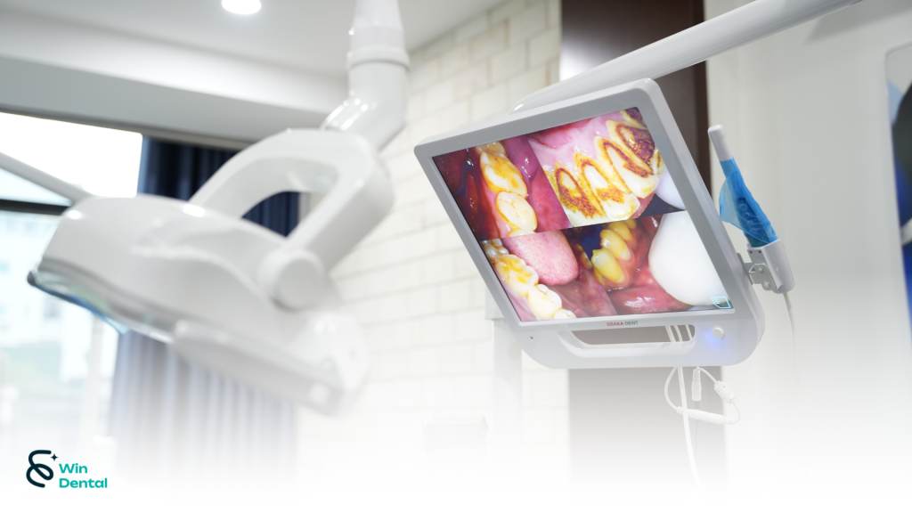 Máy soi khoang miệng Osaka Dent – Công nghệ hỗ trợ chẩn đoán nha khoa hiện đại 1 Soi