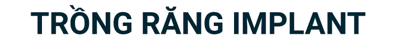 Trồng răng Implant 14 Title Trang trong rang Implant