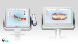 Máy iTero Element 5D Plus công nghệ quét dấu răng cho chẩn đoán & điều trị chính xác 2 iTero Element 5D Plus thế hệ máy scan trong miệng cao cấp
