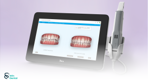 Máy iTero Element 5D Plus công nghệ quét dấu răng cho chẩn đoán & điều trị chính xác 3 iTero Element 5D Plus thế hệ máy scan trong miệng cao cấp