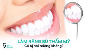 Làm răng sứ thẩm mỹ có bị hôi miệng không? Nguyên nhân & Cách khắc phục hiệu quả 2 Làm răng sứ thẩm mỹ có bị hôi miệng không? Nguyên nhân & Cách khắc phục hiệu quả
