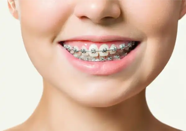 Trang chủ 50 Dich vu nieng rang