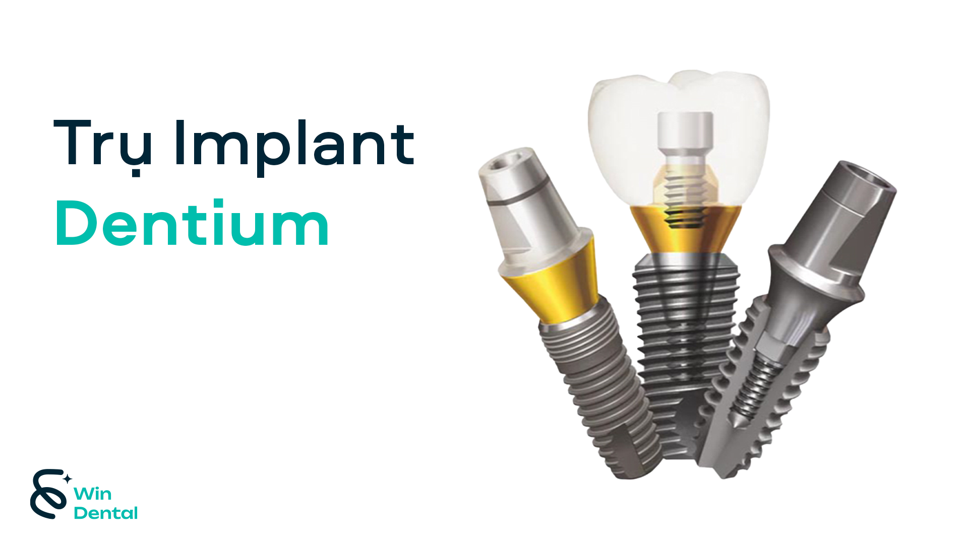 Các loại trụ Implant phổ biến hiện nay: đâu là sự lựa chọn phù hợp? 4 Trụ Implant Dentium