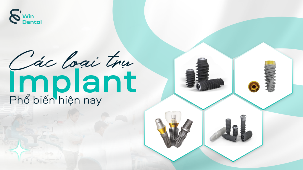Các loại trụ Implant phổ biến hiện nay: đâu là sự lựa chọn phù hợp? 1 cac loai tru implant thum