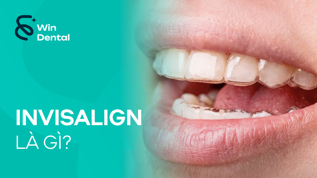 Invisalign là gì? Nguyên lý và cơ chế hoạt động của niềng răng trong suốt 1 Invisalign la gi 01